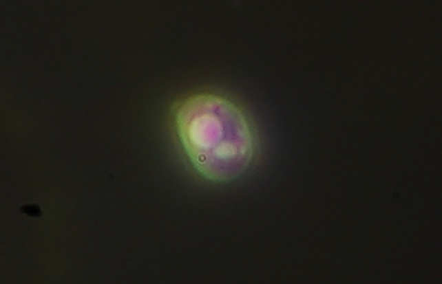 Crosta bianca del 10 febbraio - (Hyphodontia sambuci)